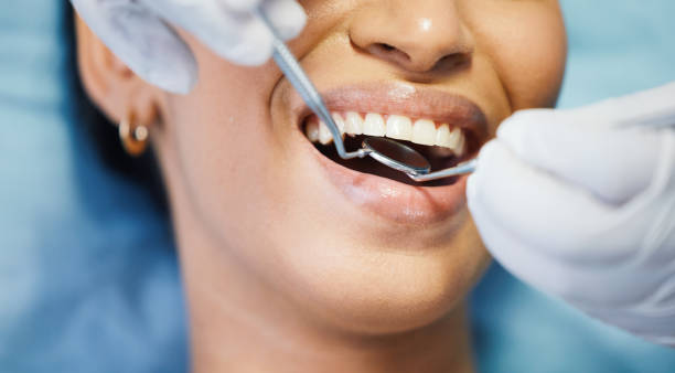 Best Broken or Cracked Tooth Emergency Dentist in Forest, OH