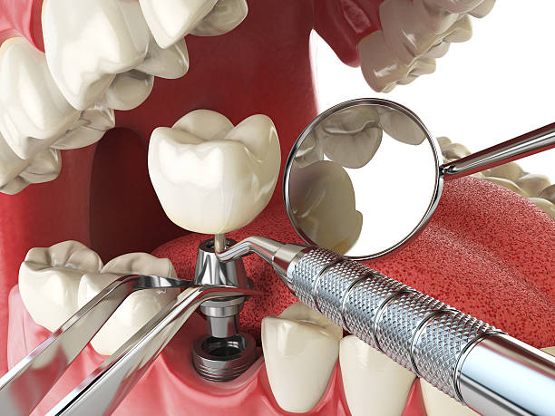 Best Weekend Emergency Dentist in Forest, OH